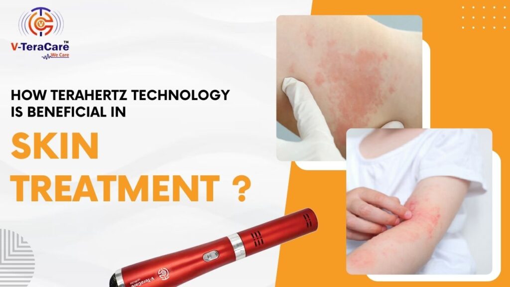 How Terahertz Technology is Beneficial in Skin Treatment?